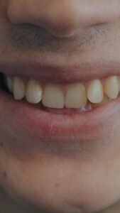 Healthy natural smile with clean teeth