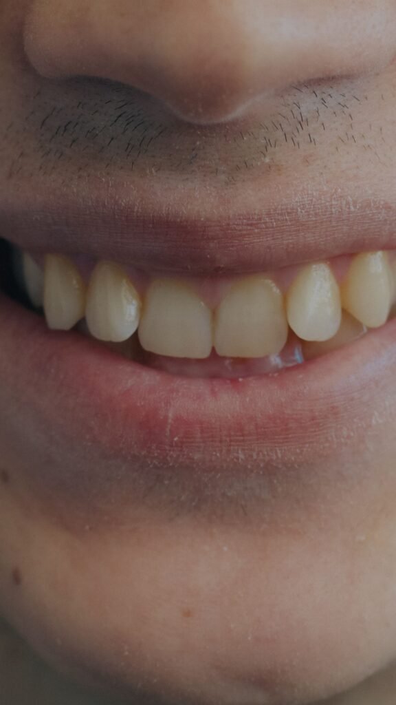 Healthy natural smile with clean teeth